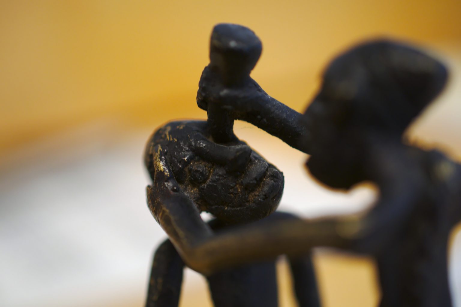 Operation des Grauen Star - Augenmed